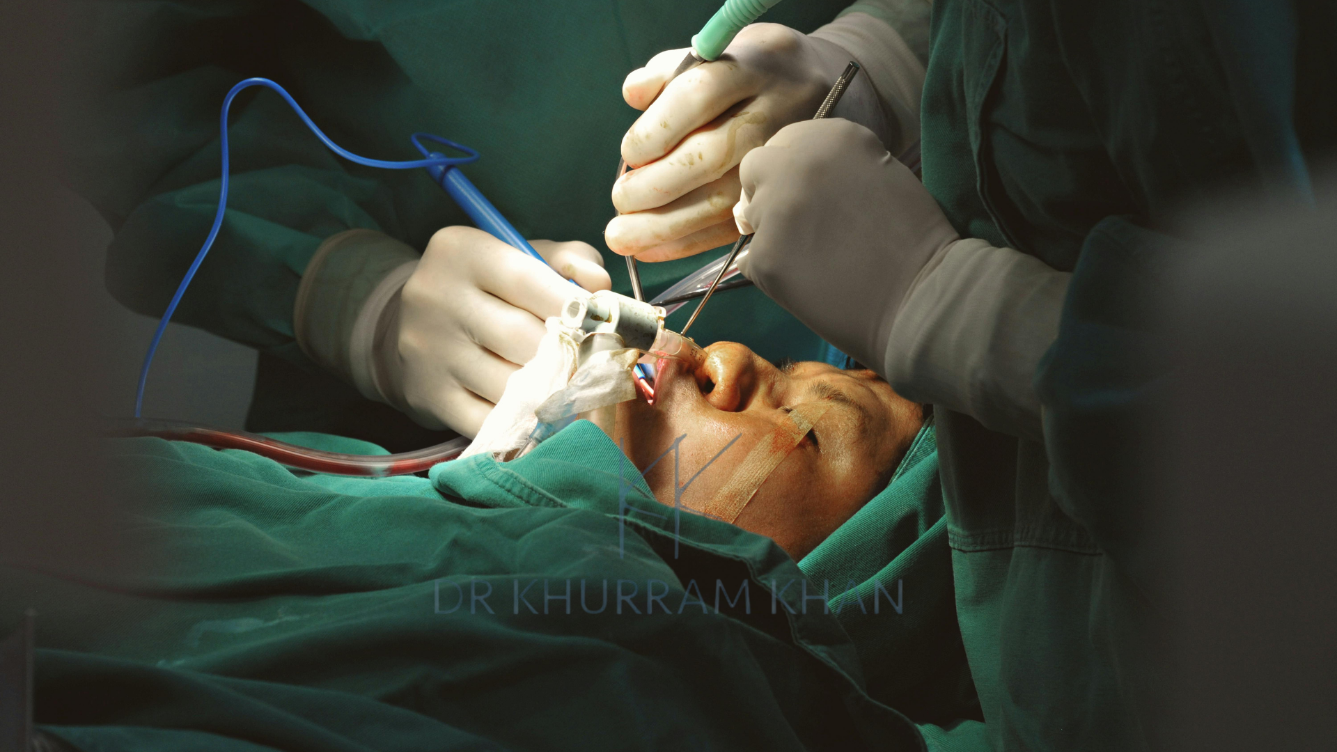 1-72e9959f-7c8e-4b71-9f57-8f5c1efa8c00-512x512 Cleft Palate Surgery uk