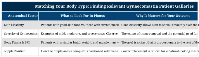 Matching Your Body Type: Finding Relevant Gynaecomastia Patient Galleries